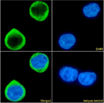 CCR5 (PKC site) Antibody [RC-10], Rabbit IgG