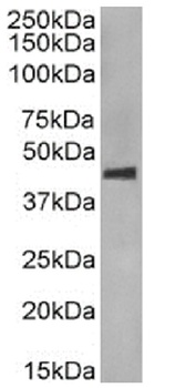 CCR5 (phosphoserine 349) Antibody [E11/19], Rabbit IgG