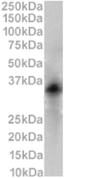 Cd79b Antibody