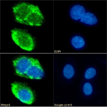 SCARB1 Antibody