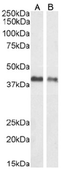 EpCAM Antibody [HEA125], Mouse IgG1