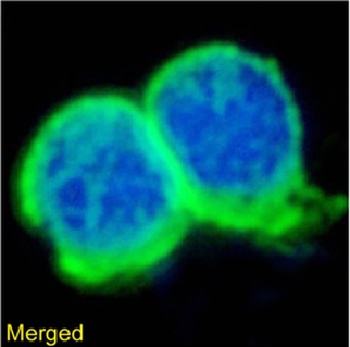 TAG-72 Antibody [Minretumomab (CC49 )], Rabbit IgG - Research Grade Biosimilar