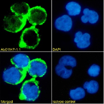 TAG-72 Antibody [Minretumomab (CC49 )], Mouse IgG1 - Research Grade Biosimilar