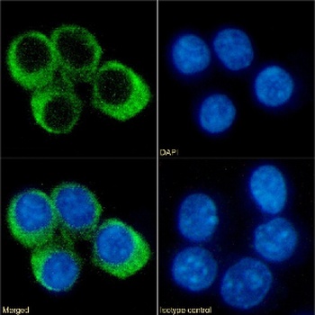 CCRL2 Antibody [BZ2E3], Rabbit IgG