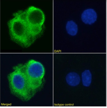 DR5 Antibody [TRA-8], Rabbit IgG