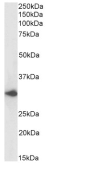 DARC Antibody [2C3], Rabbit IgG