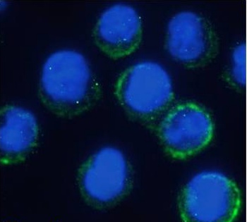 IL-6 receptor Antibody [rhPM-1 (Tocilizumab)], Rabbit IgG - Research Grade Biosimilar