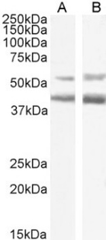 CCR4 Biosimilar Antibody