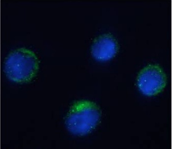 Integrin beta-7 Antibody [FIB27], Rabbit IgG