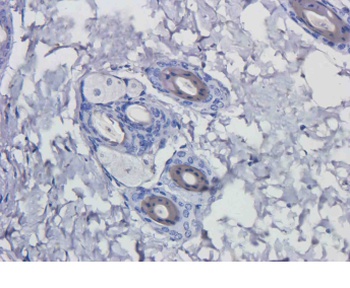 EGFR Antibody [Matuzumab], Human IgG1 - Research Grade Biosimilar