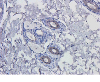 C3 Biosimilar Antibody