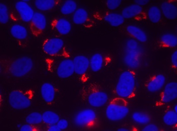 dsRNA Antibody [1D3], Rabbit IgG