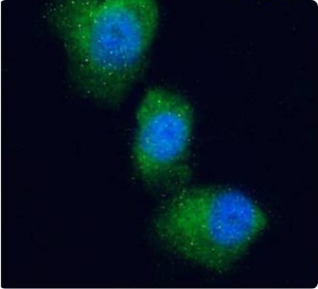 Glucose-dependent insulinotropic Receptor Antibody [Gipg013], Rabbit IgG