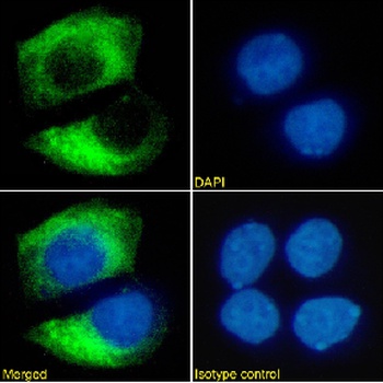 HER2/neu Antibody [SER4], Mouse IgG1