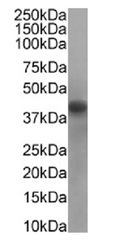 RRM2 Antibody [SAIC-30C-18], Rabbit IgG