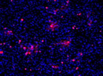 Flavivirus group antigen Antibody [D1-4G2-4-15 (4G2)], Rabbit IgG