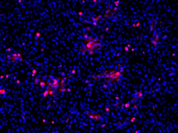 Flavivirus group antigen Antibody [D1-4G2-4-15 (4G2)], Rabbit IgG