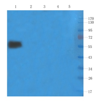 FAS Biosimilar Antibody