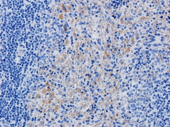 FAS Biosimilar Antibody