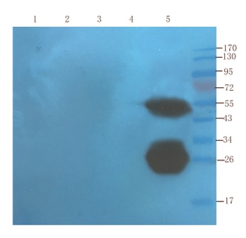 TNF Biosimilar Antibody