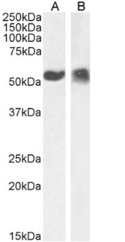 IGKV1OR1-1 Antibody