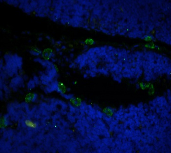 CD52 Antibody [Campath-1H], Human IgG1