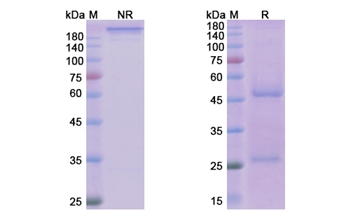 Reslizumab (IL5) - Research Grade Biosimilar Antibody