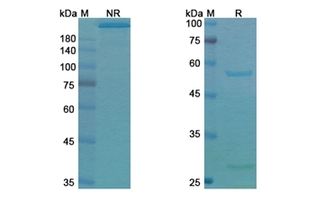 Tucotuzumab Celmoleukin (EPCAM/CD326) - Research Grade Biosimilar Antibody