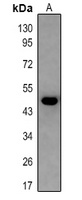 Anti-5-HT2B Antibody