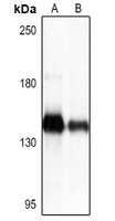 Anti-Collagen 1 alpha 1 Antibody