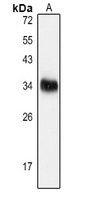 Anti-GDF15 Antibody