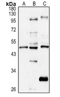 CCR3 antibody