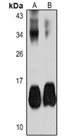 Parvalbumin alpha antibody