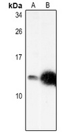 Anti-CXCL12 Antibody