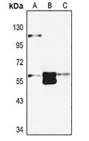 Anti-EPO Receptor Antibody