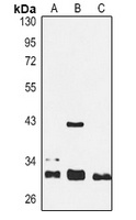 Anti-SIRT3 Antibody
