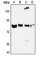 Anti-MMP9 Antibody