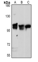 Anti-IREB2 Antibody