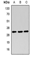 RING1b antibody