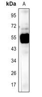 Anti-Rubisco Large Chain Antibody
