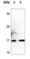 Histone H3 (MonoMethyl K26) antibody
