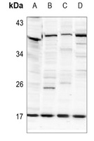 Histone H2B (AcK125) antibody