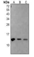 Histone H2A (AcK5) antibody