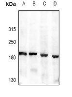 Anti-Agrin Antibody