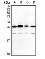 MAGEA5 antibody