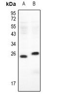 Ephrin A3 antibody