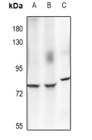 Anti-ECM1 Antibody