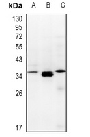 TCEAL3/5/6 antibody