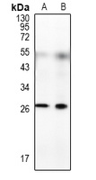 Anti-RFPL4B Antibody
