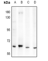 Anti-ACOT12 Antibody